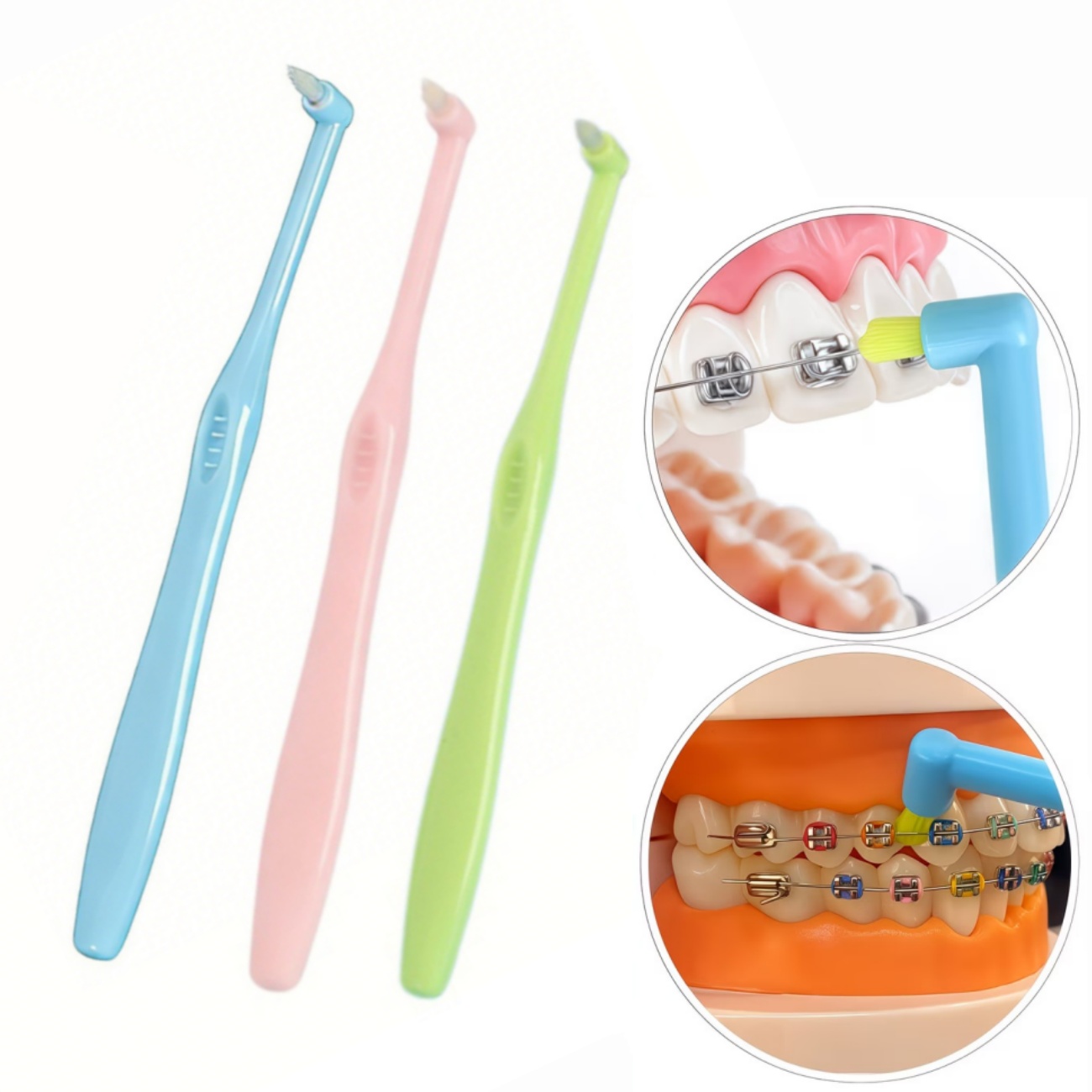 Teeth Whitening With Braces - 1/3 adet ortodontik diş teli fırçası