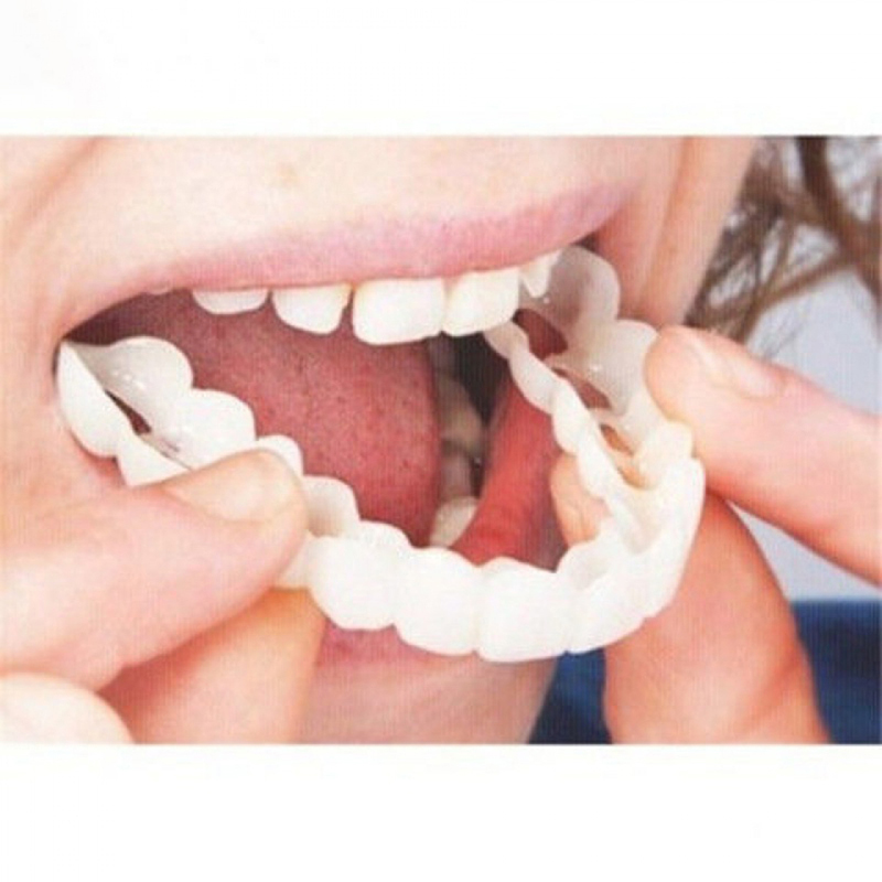 Teeth Whitening With Braces - Mükemmel Fit Yanlış Diş Kapağı Beyazlatma