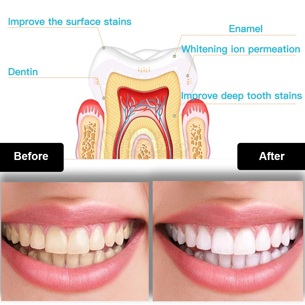 Diş Diş Beyazlatma Kiti Mini 1 - Teeth Whitening Gel Pen incelemesi ve fiyatı