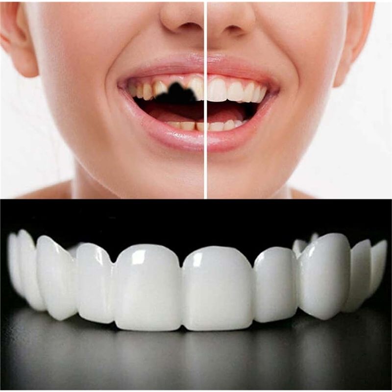 [YENİ!ABMK】 2 Çift, Güzel Gülü - Teeth Whitening With Braces incelemesi ve fiyatı